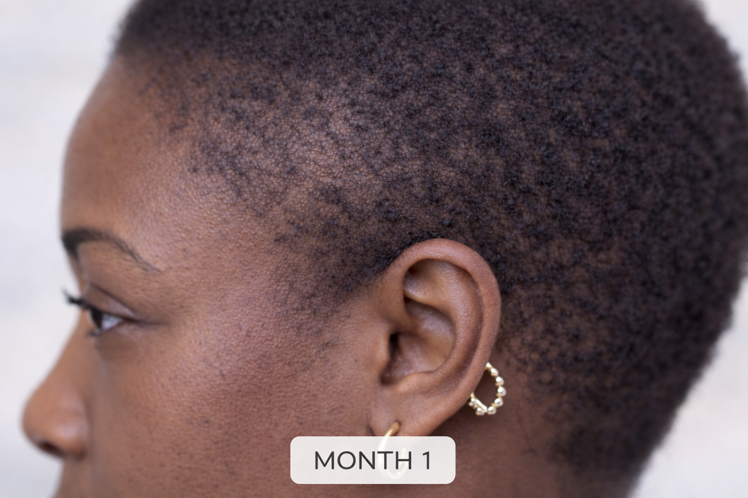 THE PEN Copper Peptide Multi-Complex Scalp Treatment | Natasha Somalia