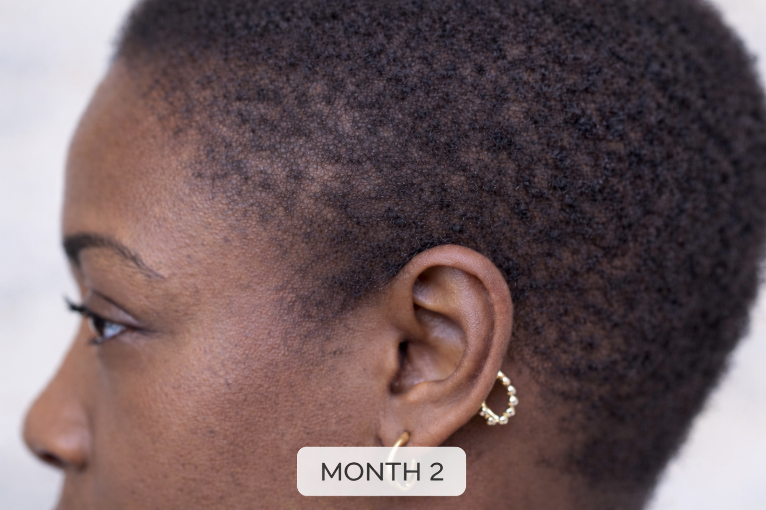 THE PEN Copper Peptide Multi-Complex Scalp Treatment | Natasha Somalia