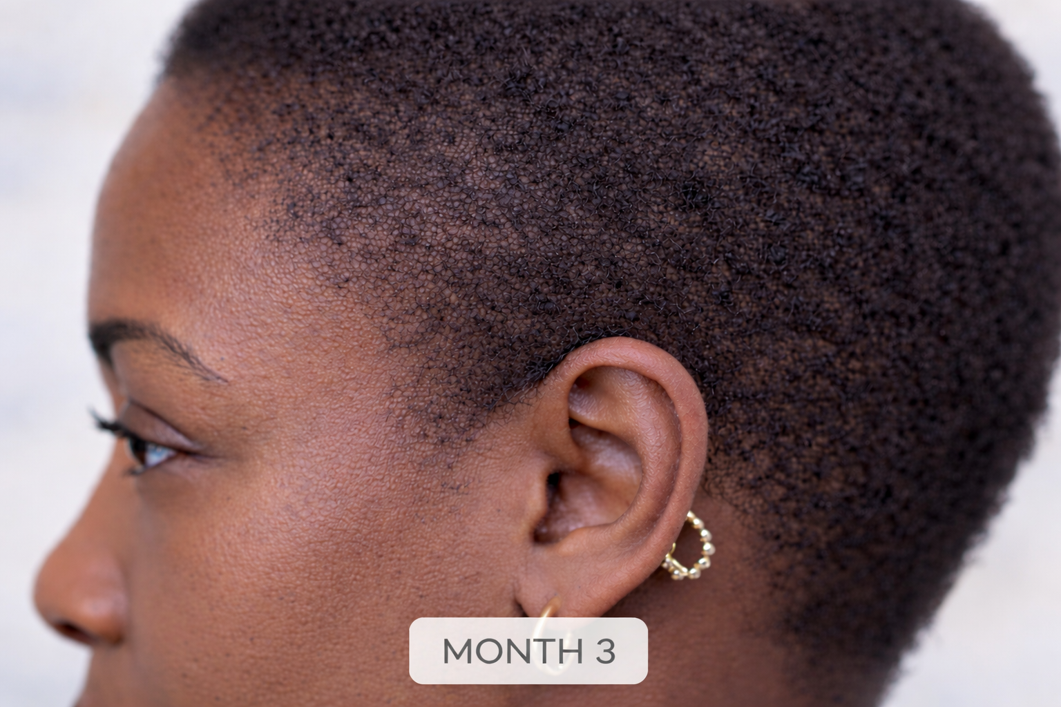 THE PEN Copper Peptide Multi-Complex Scalp Treatment | Natasha Somalia